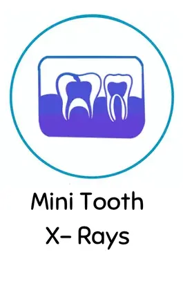 Mini Tooth X-Rays